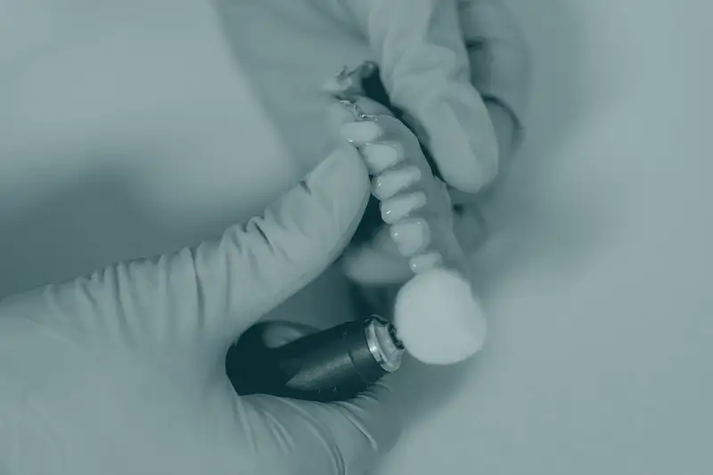 A dentist polishing a dental implant crown